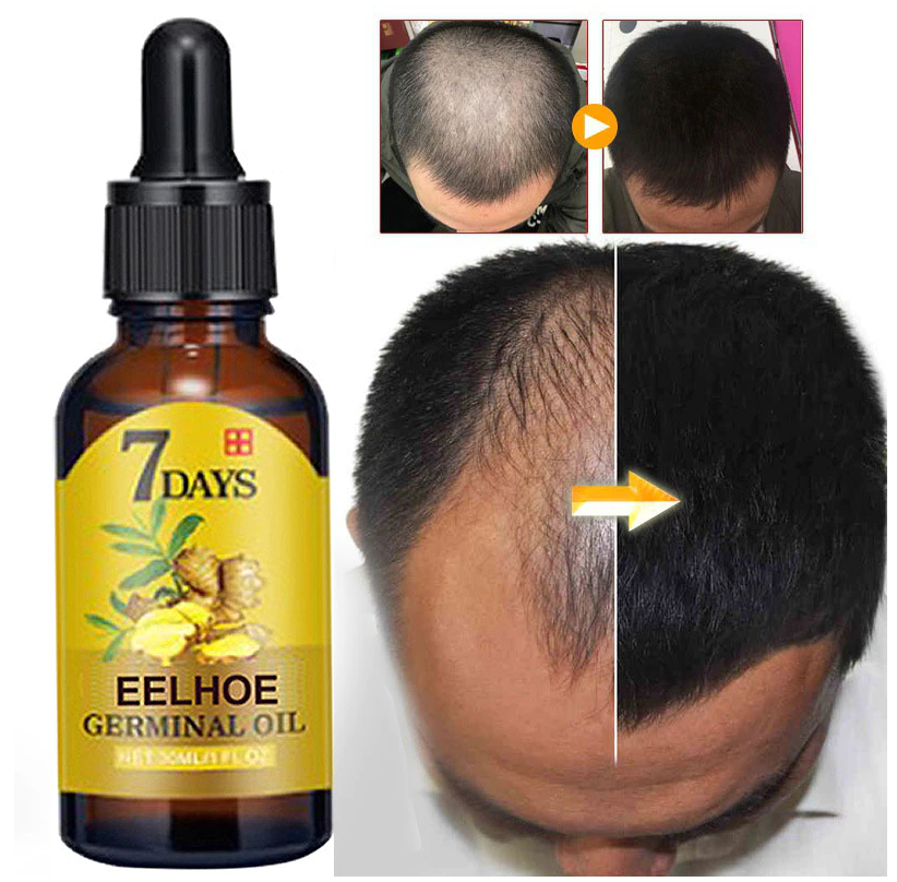 Ginger Germinal Hair Growth Serum Anti-Hair Loss Spray Repair Damaged Hair Treatment